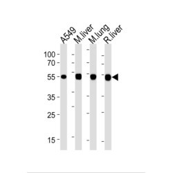 Aldehyde Dehydrogenase, Mitochondrial (ALDH2) Antibody