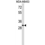 Inhibitor of Growth Protein 1 (ING1) Antibody