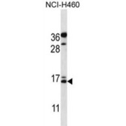 Osteocalcin (BGLAP) Antibody