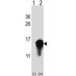 Cystatin A (CSTA) Antibody