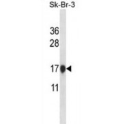 Cystatin-B (CSTB) Antibody