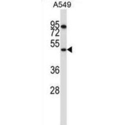 SWI/SNF Related, Matrix Associated, Actin Dependent Regulator of Chromatin, Subfamily E, Member 1 (SMARCE1) Antibody