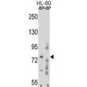 Ring Finger Protein 40 (RNF40) Antibody