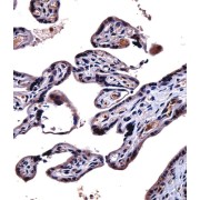 Interleukin 9 Receptor (IL9R) Antibody