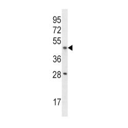 Interleukin 9 Receptor (IL9R) Antibody