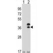 Distal-Less Homeobox 5 (DLX5) Antibody