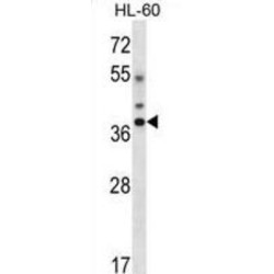 Distal-Less Homeobox 5 (DLX5) Antibody