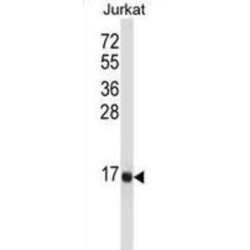 Tachykinin-3 (TAC3) Antibody