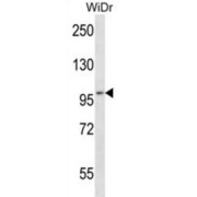 Eukaryotic Translation Initiation Factor 4E Transporter (EIF4ENIF1) Antibody