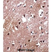 LIM Domain-Binding Protein 2 (LDB2) Antibody