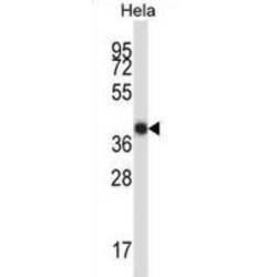 LIM Domain-Binding Protein 2 (LDB2) Antibody