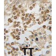 Developmental Pluripotency-Associated Protein 4 (DPPA4) Antibody