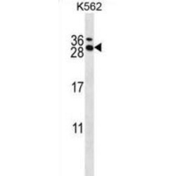 Calcipressin-3 (RCAN3) Antibody