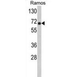 POTE Antibody