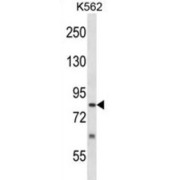 SUMO1/Sentrin Specific Peptidase 5 (SENP5) Antibody