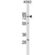 Replication Protein A 70 kDa DNA-Binding Subunit (RPA1) Antibody