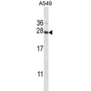 DNA-Directed RNA Polymerases I, II, And III Subunit RPABC1 (POLR2E) Antibody