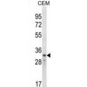 G1/S-Specific Cyclin-D2 (CCND2) Antibody