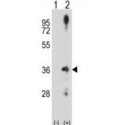 G1/S-Specific Cyclin-D2 (CCND2) Antibody