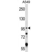 Glutamate Receptor Ionotropic, Kainate 2 (GRIK2) Antibody