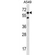 E3 Ubiquitin-Protein Ligase CHFR (CHFR) Antibody