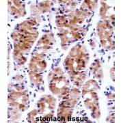 General Transcription Factor IIE, Polypeptide 1 (GTF2E1) Antibody