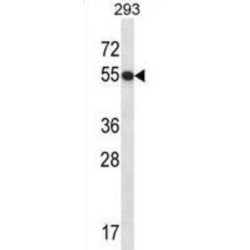 General Transcription Factor IIE, Polypeptide 1 (GTF2E1) Antibody