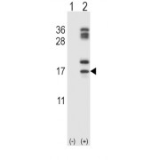 Galectin 10 (CLC) Antibody