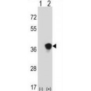 Dual Specificity Mitogen-Activated Protein Kinase Kinase 3 (Map2k3) Antibody