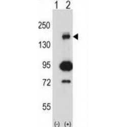 Mitogen-Activated Protein Kinase Kinase Kinase 5 (Map3k5) Antibody