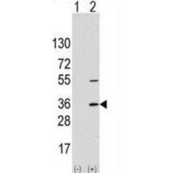 Translocon-Associated Protein Subunit Alpha (SSR1) Antibody