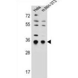 Translocon-Associated Protein Subunit Alpha (SSR1) Antibody