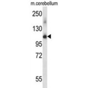 Mouse Prpf4b Antibody