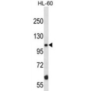 Mouse Taok2 Antibody