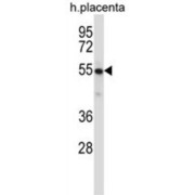 Tyrosine-Protein Kinase Yes (YES1) Antibody