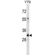 Olfactory Receptor 4F16 (OR4F16) Antibody