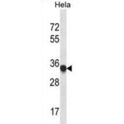 Myosin Light Chain 3 (MYL3) Antibody