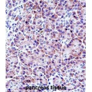 Chymotrypsin Like Elastase Family Member 3A (CELA3A) Antibody