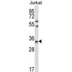 Chymotrypsin Like Elastase Family Member 3A (CELA3A) Antibody