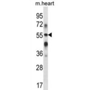 Beta-1,3-Galactosyltransferase 2 (B3GALT2) Antibody