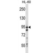 Ubiquitin Carboxyl-Terminal Hydrolase 20 (USP20) Antibody