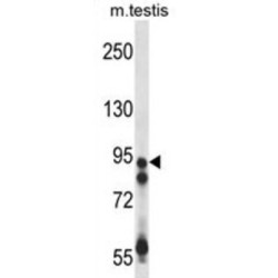 Ubiquitin Carboxyl-Terminal Hydrolase 20 (USP20) Antibody