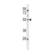 ETS Translocation Variant 6 (ETV6) Antibody