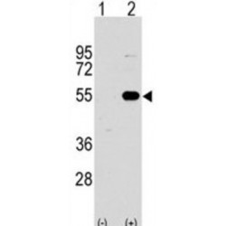 Sprouty-Related, EVH1 Domain-Containing Protein 1 (SPRED1) Antibody