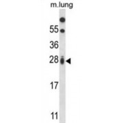 GTP-Binding Protein Rit1 (RIT1) Antibody