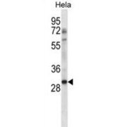 Non-Homologous End-Joining Factor 1 (NHEJ1) Antibody