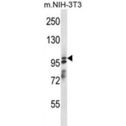 Arf-GAP With SH3 Domain, ANK Repeat And PH Domain-Containing Protein 1 (ASAP1) Antibody