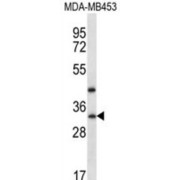 TATA-Box Binding Protein Associated Factor 9b (TAF9B) Antibody