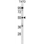 ADP-Ribosylation Factor GTPase Activating Protein 3 (ARFGAP3) Antibody