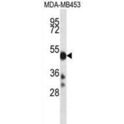 Cytochrome P450 2D6 (CYP2D6) Antibody